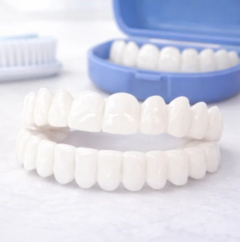 Facetas Dentárias Removíveis